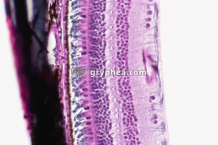 Rétine périphérique x100 - gryphea.org